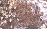 Spider1